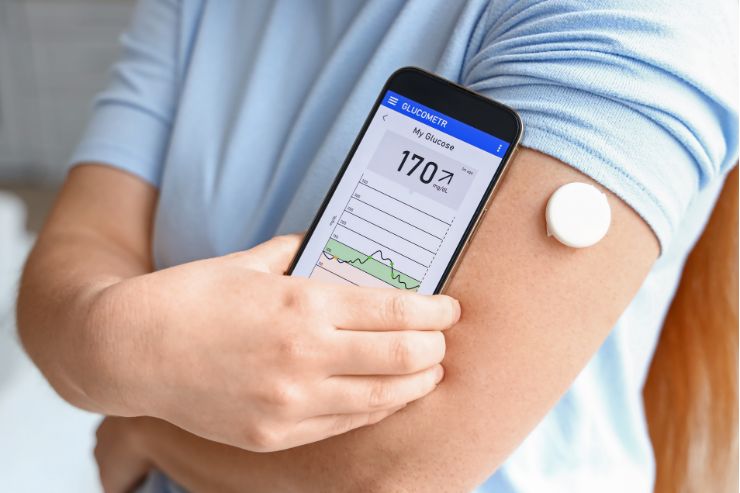 Continuous Glucose Monitoring